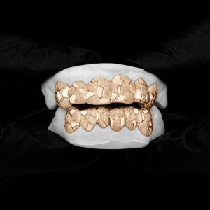 Yellow Gold Nugget Cut Style Grillz