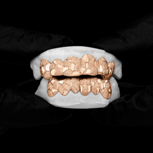 Rose Gold Nugget Cut Style Grillz - GotGrillz