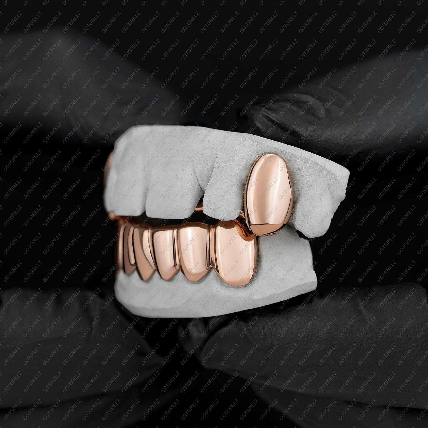 Rose Gold Teeth