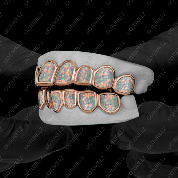 Opal Stone Custom Grillz