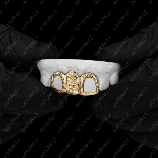 Custom 3 piece Yellow Gold Diamond Cut Solid and Open Face Grillz