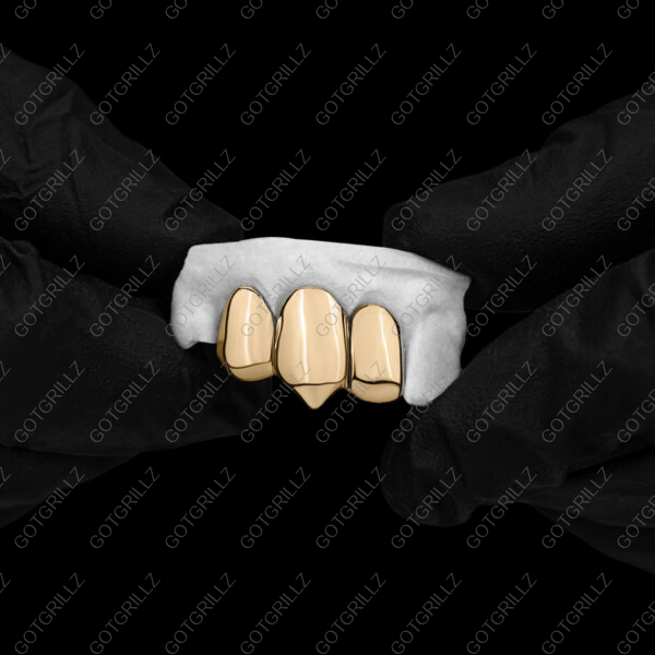 Custom 3 piece Yellow Gold Solid Grillz with Extended Fangz